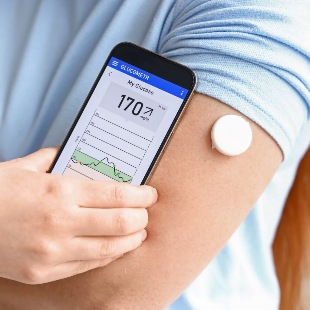 continuous glucose monitoring for blood sugar